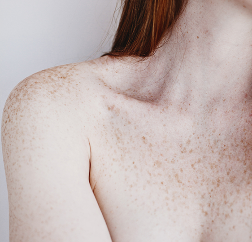 women's bare shoulder