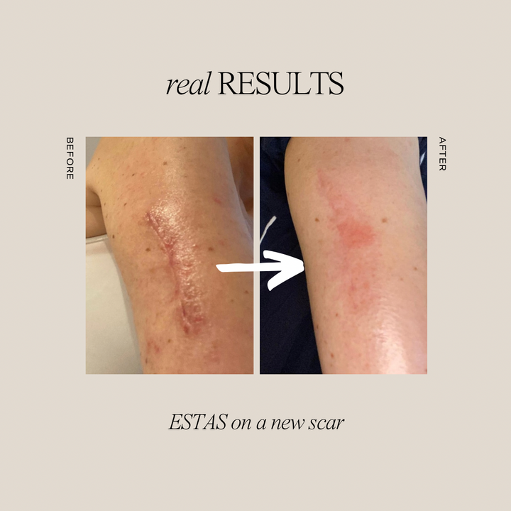 ESTAS Essentials Healing Ritual